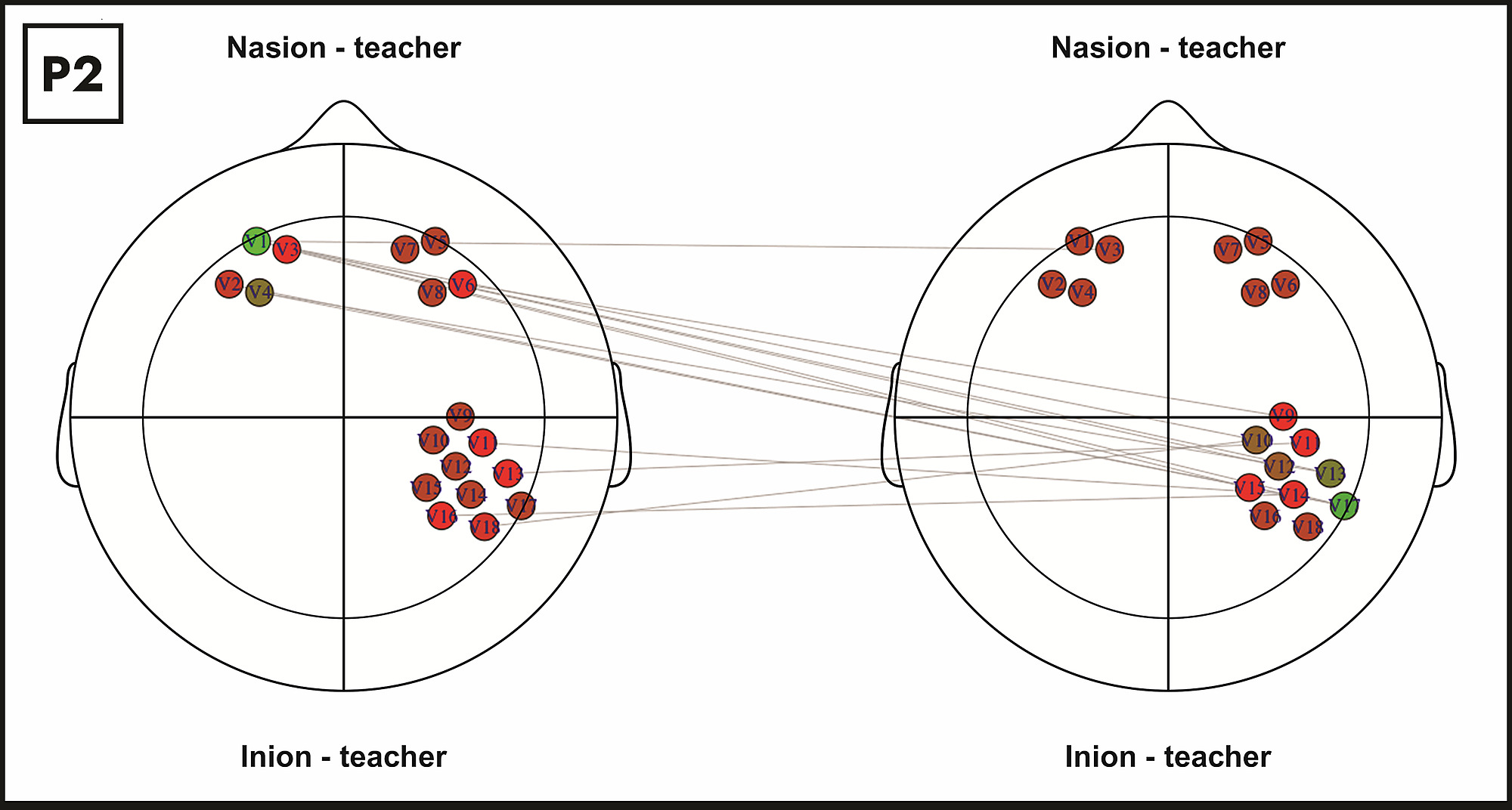 applications-of-graph-theory-to-the-analysis-of-fnirs-data-in